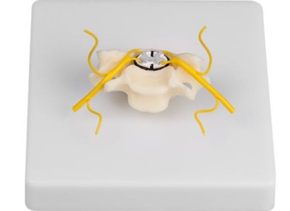 https://www.jayakelana.jayakelana.id/uploads/product/-4067-vertebra-with-spinal-952539f2afe432b_cover.jpg