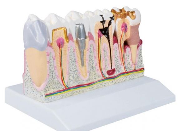 https://www.jayakelana.jayakelana.id/uploads/product/-d250-dental-model-4-74088418ba20bdb_cover.jpg