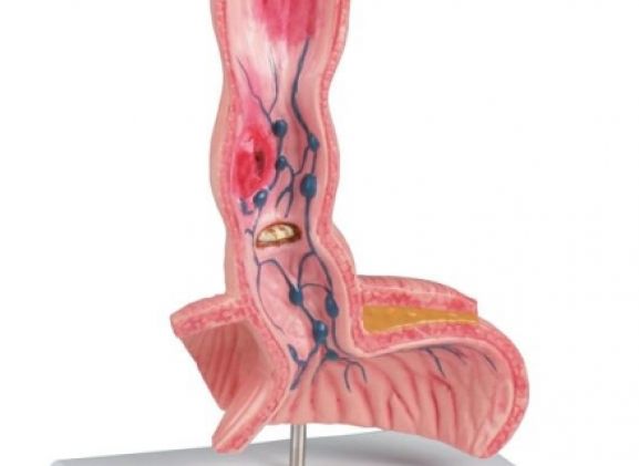 https://www.jayakelana.jayakelana.id/uploads/product/-k218-oesophagus-diseases-91822f04ad01eaf_cover.jpg