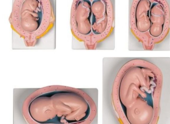 https://www.jayakelana.jayakelana.id/uploads/product/-l204-pregnancy-model-set--3240079c3983ebe_cover.jpg