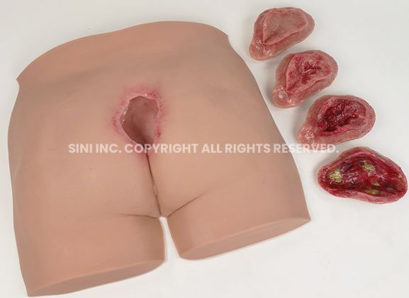 https://www.jayakelana.jayakelana.id/uploads/product/-p-deu-01-decubitus-ulcer-trainer-36706786ebaa4b7_cover.jpg