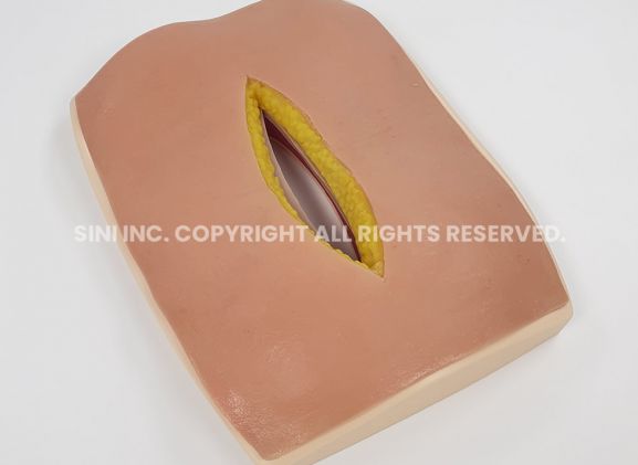 https://www.jayakelana.jayakelana.id/uploads/product/-s-afs-01-abdominal-fascia-suture-968431c7eb30eca_cover.jpg