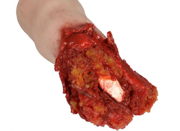 https://www.jayakelana.jayakelana.id/uploads/product/-x1401-amputated-leg-task-87615f400118ff0_cover.jpeg