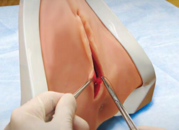 https://www.jayakelana.jayakelana.id/uploads/product/pelatih-perineal-perineal-prt-20--41963e3954c122f_cover.png