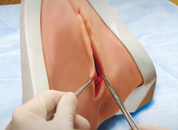 https://www.jayakelana.jayakelana.id/uploads/product/perineal-repair-replaceable-tissue-12948e3954c122f_cover.png