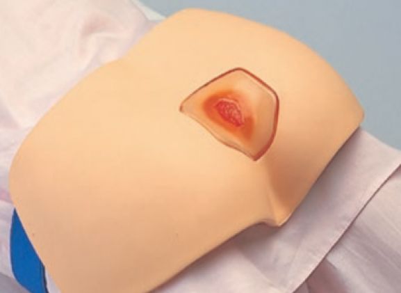 https://www.jayakelana.jayakelana.id/uploads/product/simulator-pengobatan-decubitus-m156--123164a81d274ef_cover.png